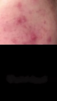 خلطة الملكية • تبييض فوري • فوريفر