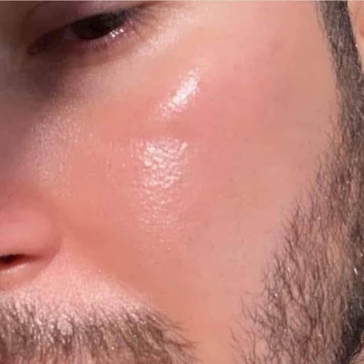 سلام عليكم  حبايب كلبي رجعت توفرت الخبطه  ومثل ما تعرفون  معالجه الحب شباب والكلف وتصبغات تبيض البشره وتعالجه وتنطي نضاره حلوه وشد البشره  كل شغلات جانبيه  مابيه امانت الله وانتو مجربينه   تستخدم رجاليه ونسايه  العلبه ب 12 الف اليحب   يدخل خاص


**إذا كنت صاحب هذا الإعلان وتريد حذفه لأي سبب، رجاءا أرسل رسالة إلى الدعم الفني**