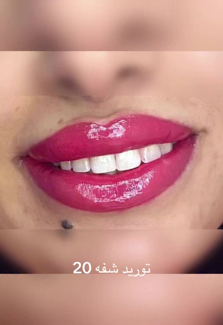 تاتو بلوك 15رموش كامله 10طرفيه 5مسح تاتو قديم 10توريد شفه 15


**إذا كنت صاحب هذا الإعلان وتريد حذفه لأي سبب، رجاءا أرسل رسالة إلى الدعم الفني**