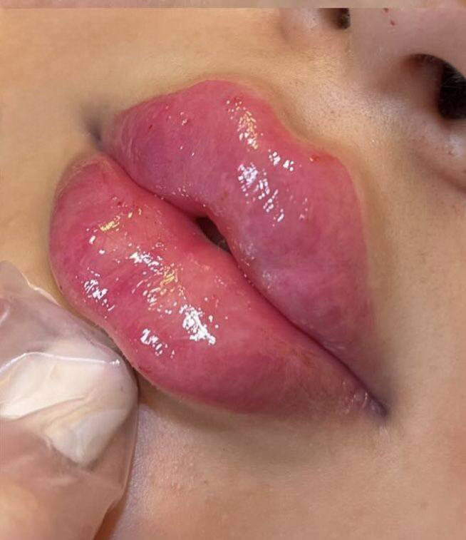 عروض العيد الفطر 
تغير شامل 250الف                                             فلر شفه سعر السيسي 50الف رقم الهاتف ‏‪***********‬‏
