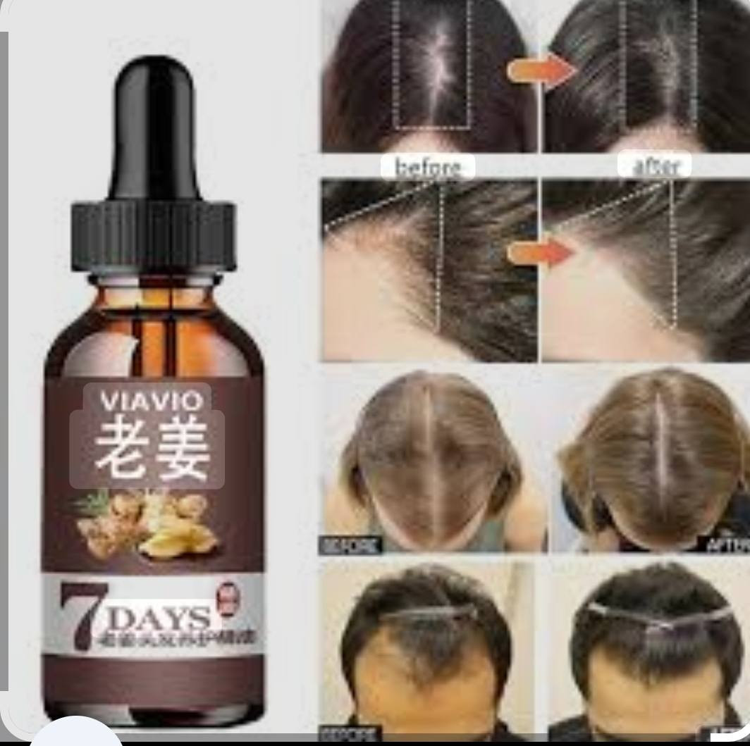 مجموعة من العناية ب الشعر والبشره من اجود الماركات الكوريا واليابانيه وبانسب الأسعار
الطلب الي عبر 25 توصيل مجاني


**إذا كنت صاحب هذا الإعلان وتريد حذفه لأي سبب، رجاءا أرسل رسالة إلى الدعم الفني**