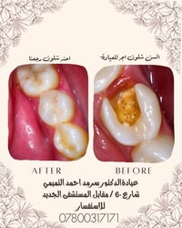 د. سرمد التميمي • حجز واتساب • شارع ٦٠