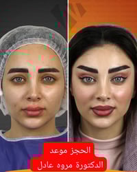 ✨ الدكتورة مروه عادل العامري لأول مرة في العراق 🇮🇶 تغيير شامل وتجميل ا...