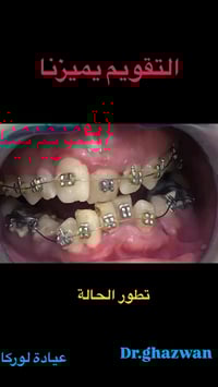 التقويم يميزنا الصورة تتكلم عن مدى صعوبة و تعقيد الحالة عدم اكتمال نمو...