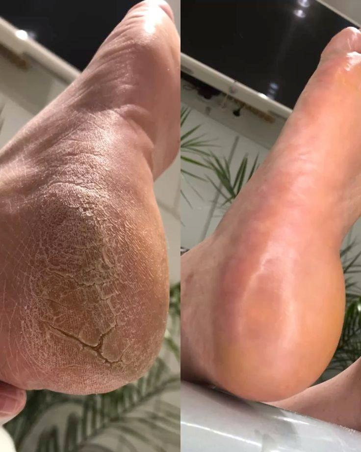 *********** عروض العيد
قص شعر 10✂️💇
حفافه + صبغ حاجب + تنضيف بشره 10💅
تاتو بلوك 40 💄
تسريح حسب الشعر 👸
تنضيف قدم 15🦶💅
رموش اسبوعيه 10
ثقب إذن 5 👂
وشوم حسب الرسمه
 توريد شفه 20، 👄
