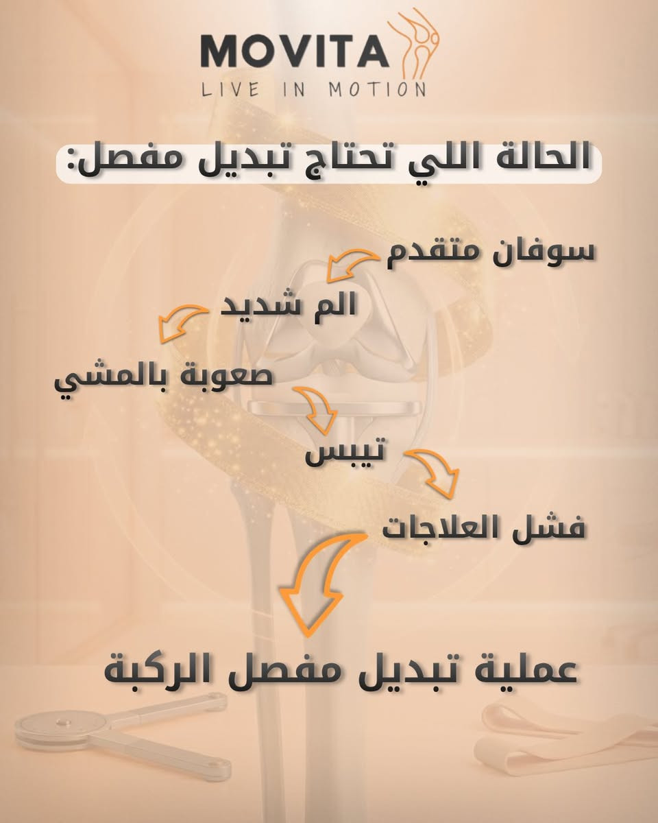 🎥 على شنو يعتمد نجاح عملية تبديل مفصل الركبة (TKA)؟
🎉 بمناسبة عيد الغدير الأغر، يسرّنا الإعلان عن معاينة مجانية لفترة محدودة لجميع المراجعين الكرام.
🏥 في مركز موفيتا للعلاج الطبيعي نوفر خدمات متخصصة في:
✅ تأهيل ما قبل عملية تبديل مفصل الركبة 
✅ تأهيل ما بعد عملية تبديل مفصل الركبة (TKA) 
✅ استعادة مدى الحركة للمفصل 
✅ تقوية عضلات الفخذ والساق لتحسين المشي والحركة 
✅ تحسين التوازن والقدرة الوظيفية اليومية ✅ تقليل الألم والتورم بعد العملية 
✅ تدريب المريض على المشي الصحيح واستخدام وسائل المساعدة 
✅ العلاج اليدوي وتقنية الموليغان (Mulligan Concept)
📌 من الحالات التي قد تحتاج إلى تبديل مفصل الركبة: 
🔹 خشونة الركبة المتقدمة 
🔹 تآكل الغضاريف الشديد 
🔹 التشوهات المتقدمة في مفصل الركبة 
🔹 الألم المزمن الذي يحد من الحركة والنشاط اليومي
⭐ نجاح عملية تبديل مفصل الركبة يعتمد على: ✔️ دقة العملية الجراحية 
✔️ الالتزام ببرنامج التأهيل 
✔️ استعادة مدى الحركة والقوة العضلية 
✔️ المتابعة المنتظمة مع فريق التأهيل 
✔️ ممارسة التمارين العلاجية بالشكل الصحيح
💡 إذا كنت تعاني من آلام الركبة أو مقبل على عملية تبديل مفصل الركبة، فلا تهمل التأهيل الصحيح.

👨‍⚕️👩‍⚕️ كادر متخصص رجالي ونسائي.

📍 العنوان: بغداد – الكرادة – شارع 42 – داخل مركز بغداد الرياضي – الطابق الأرضي

📱 للحجز والاستفسار: ***********
🌐 تابعونا على:
 📸 Instagram: @movita.iq 
🎵 TikTok: @movitaiq 
📘 Facebook: موفيتا للعلاج الطبيعي

MOVITA – LIVE IN MOTION 🤍
#موفيتا #موفيتا_للعلاج_الطبيعي #العلاج_الطبيعي #تبديل_مفصل_الركبة
