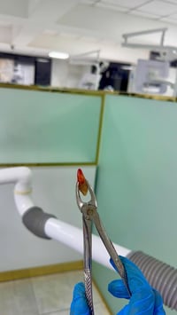 تنظيف اسنان • قلع جذور • مجاناً