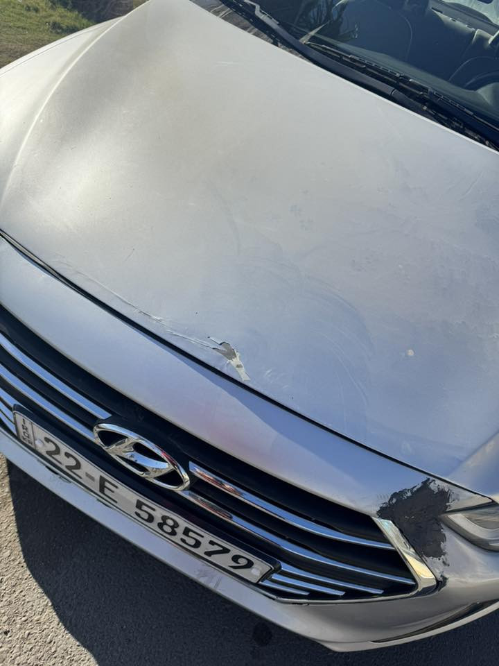 السلام عليكم
النترا موديل 2018 ماشيه 56الف حادث خفيف  بيهه صبغ جاملغ جهه السايق وبنيد وربع الجاملغ الايمن ودعاميات سياره جديدة استخدام شخصي رقم اربيل هزة جديدة سنوية لل 2029 سعر 123 بيها مجال مكان كاظمية رقم ***********
