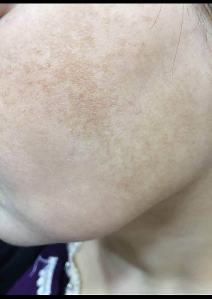 بكج كلف او تصبغات تجارب الزبائن


**إذا كنت صاحب هذا الإعلان وتريد حذفه لأي سبب، رجاءا أرسل رسالة إلى الدعم الفني**