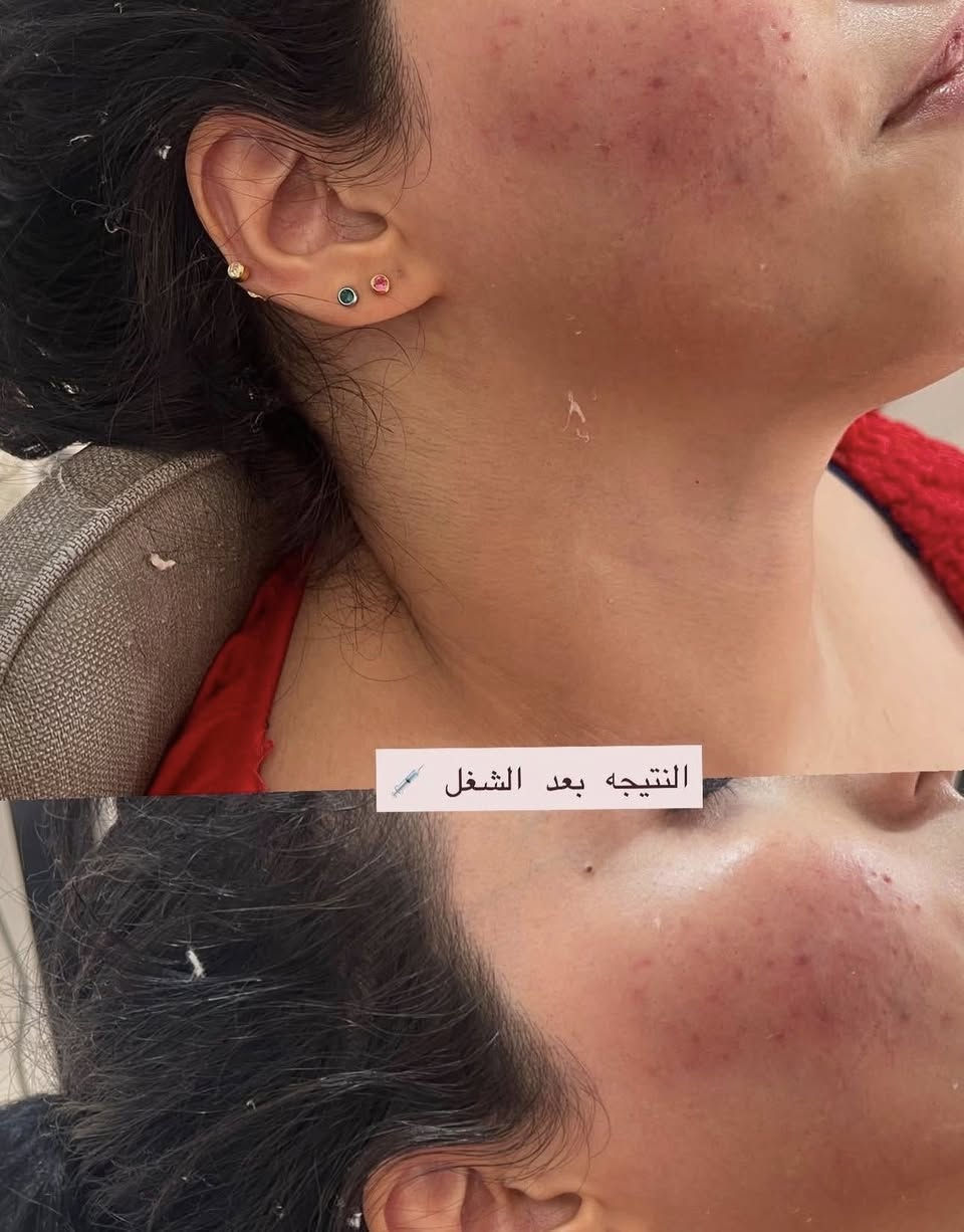 فلر وجه سعر السيسي ٥٠
فلر شفه سعر السيسي ٥٠ 
نضاره فوريه سعرها ٥٠ الف


**إذا كنت صاحب هذا الإعلان وتريد حذفه لأي سبب، رجاءا أرسل رسالة إلى الدعم الفني**