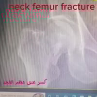 دكتور عظام • جراحة عمود فقري • طوزخورماتو