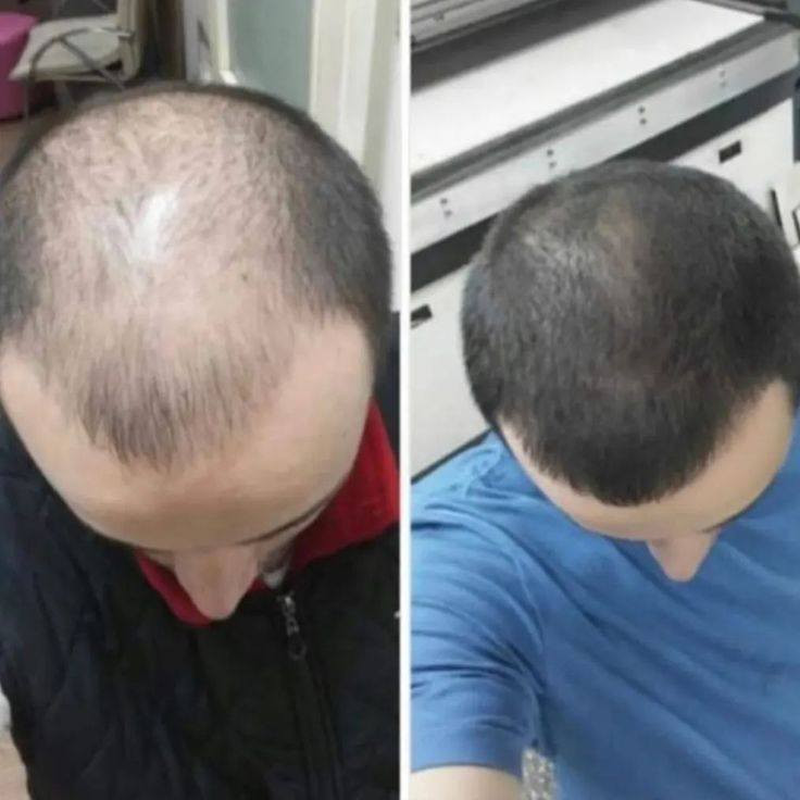 حلمكم حقيقة


**إذا كنت صاحب هذا الإعلان وتريد حذفه لأي سبب، رجاءا أرسل رسالة إلى الدعم الفني**