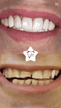 تاهيل فك كامل علوي وسفلي 
للحجز والاستفسار الاتصال بنا ***********
أهلا وسهلا بكم مراجعينا الكرام
