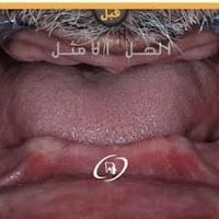 دكتور أسنان • عمل مجاني • الحلة شارع ٤٠