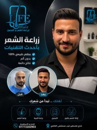✨ مو كل زراعة شعر تنطي هالنتيجة… السر بالتخطيط والخبرة والتقنية المناس...