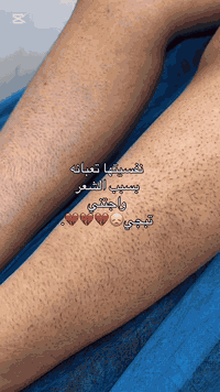 ازالة شعر الوجه • كانديلا • سوك العبيدي