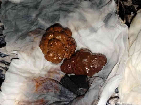 كلمن وسعره المحابس على 50 اي شي يعجبكم المراسله خاص او واتساب ***********
