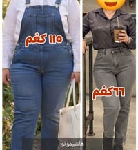 نزول وزن • هاشيموتو • ديالى المقدادية