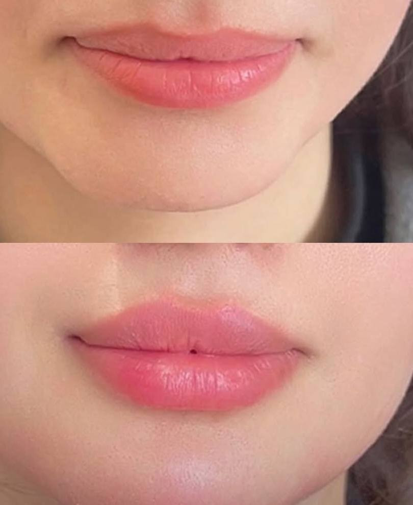 عروض خلال فتره العيد
عياده تينا
تنضيف البشره
تغيير الشامل
رسمه شفايف والذقن
راسلونا
***********

