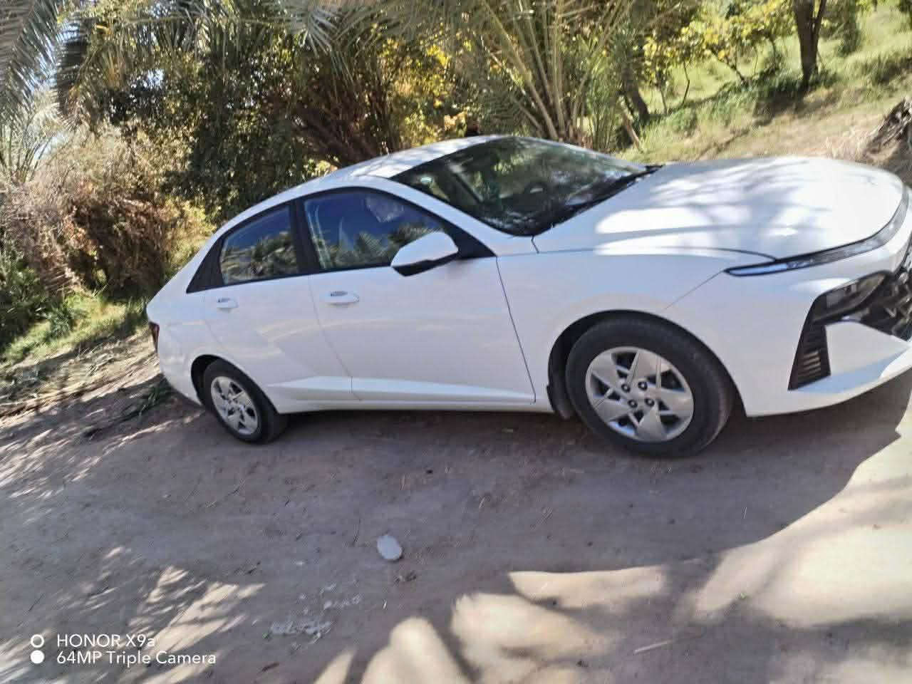 للبيع خمسة سيارات #اكسنت ب اسعار مناسب ✅
اكسنت خليجي 2007✅
للبيع اكسنت 2017 ✅
للبيع اكسنت 2014 ✅
للبيع اكسنت 2024 ✅
اكسنت 2013 خليجي ✅

سعرها والتفاصيل موجودة ع رابط قناة تلكرام https://t.me/carssofiraq
.
أو اكتب في بحث تلكرام :
👈كروب سيارات العراق 🇮🇶
وشوف سعر والتفاصيل بنفسك✔


**إذا كنت صاحب هذا الإعلان وتريد حذفه لأي سبب، رجاءا أرسل رسالة إلى الدعم الفني**