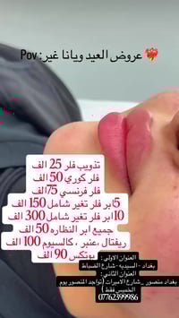 عروض العيد ويانا تختلف  تذويب فلر 25 الف فلر كوري 50 الف  فلر فرنسي 75...