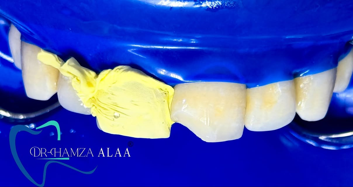 العنوان بسمايه الشارع العام 📍
للحجز والأستفسار مراسلة الصفحة او عن طريق الواتساب *********** 📞
