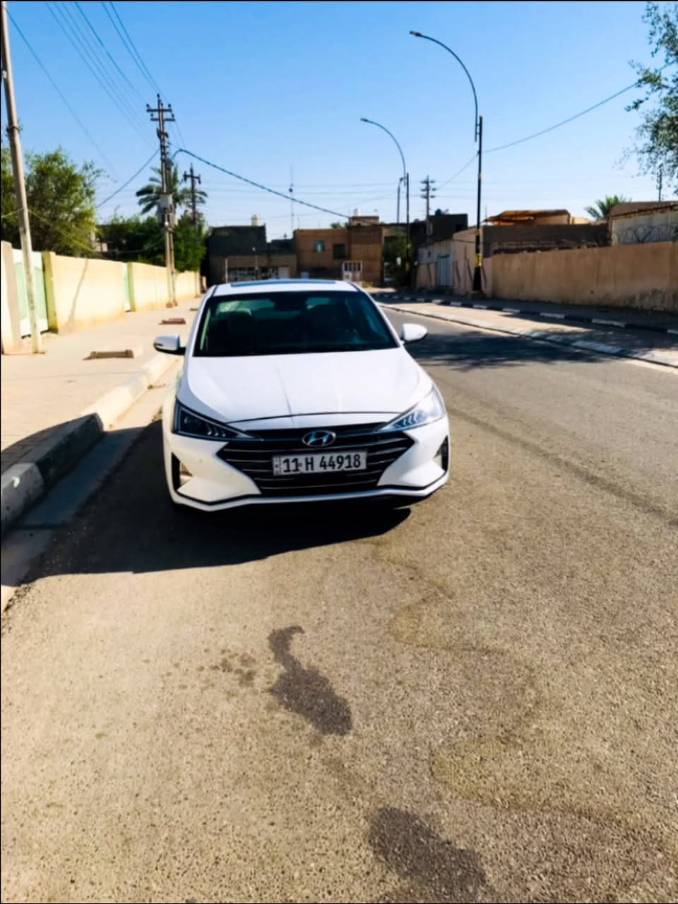 السلام عليكم النترا موديل 2019 السياره مكفوله كفاله عامه من الصبغ والبارد والتبديل اربع وضعيات قياده نورمال ايكو سبورت سمارت سياره بصمه فتحه والسعر 155 وبيه مجال كلش بصيط وجماعت ال 150تره مابيع الارقم ***********
