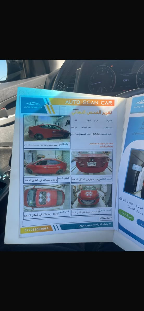 سلام عليكم النترا موديل ٢٠١٧ وارد ارمريكي حادثهه جاملغ وباب خلفي مواصفتهه فول ماعدا كشنات جلد ماشيه ١٥٠ سياره. مبدل بيهه مكينه جديده سعر ١٢٠ بي مجال مكانه الطوبجي ***********
