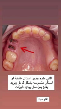 البصرة الجبيلة • عيادات الكنوز • موعد غدا