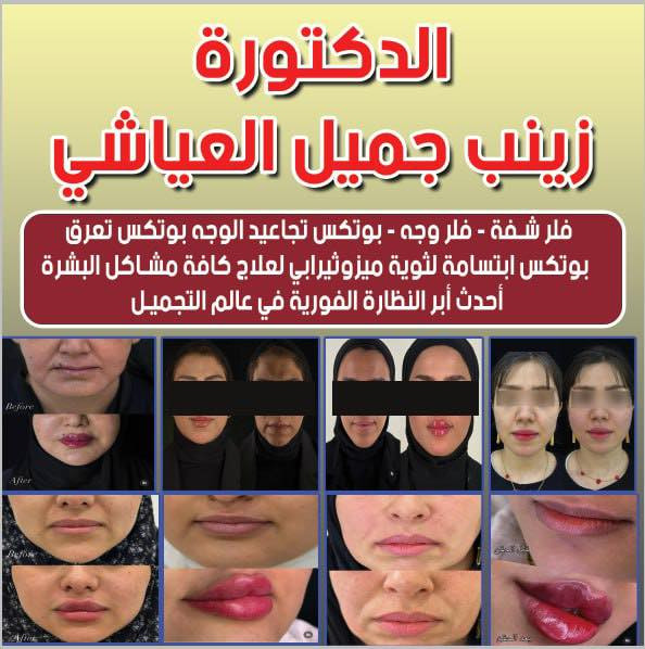 ✨ ليست مجرد ابتسامة... إنها بداية الثقة الجديدة! ✨
نطلق رسمياً عيادة الدكتور حسين علي الزهيري بحلتها الثانية في موقعها الجديد بالنجف الأشرف.
شاهدوا نتائجنا السابقة التي تعكس التزامنا بالخبرة المتميزة في:
✅ الابتسامة الرقمية (DSD) والتبييض الاحترافي.
✅ علاج الجذور المتقدم بأحدث التقنيات.
📍 موقعنا: النجف الأشرف، شارع القدس، أنصار، مجاور صيدلية مريم العيسى.
📞 للاستشارات والتفاصيل (التواصل عبر الرقم):*********** / ***********.
#نتائج_عيادة_الزهيري #تجميل_أسنان #النجف_الأشرف #الدكتور_حسين_الزهيري #علاج_جذور
