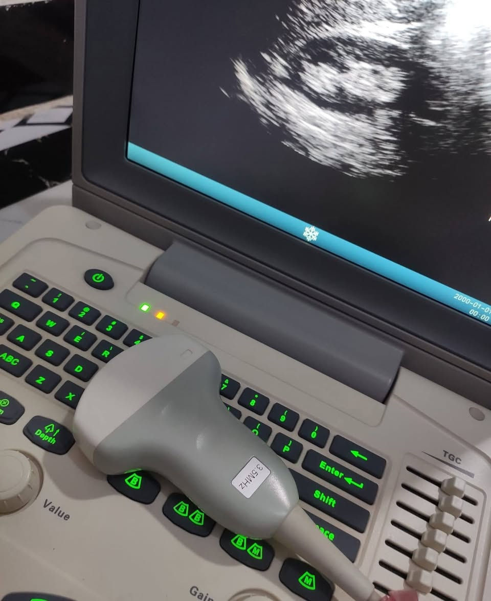 (( جهاز سونار للبيع ))
- جهاز سونار نوع citymed مستعمل وبسعر مناسب جدا ...
 & اطبائنا الكرام &
- يوجد لدينا جهاز سونار مستعمل :-
اسم الجهاز :  citymed
سنة الصنع : 2022
المنشا : ايطالي
الملحقات : بروب convex 
نوع الجهاز : 2D  
مع جميع فحوصات
حالة الجهاز : ممتاز
وضوح الصورة : ممتاز
- للحجز والاستفسار يرجى مراسلة الصفحة او الاتصال على الرقم التالي :-
***********
وبسعر جدا جدا مناسب 💥💥

#أجهزةطبيةمستعملة #أجهزةسونار #سونار #اجهزةطبية #سونارمستعمل #سونارات #سامسونك #اجهزةطبيةجدبدة #اشعة #اشعةوسونار #اطباءسونار #سونرات #مهندس #sonoace #مستلزمات #طبية #فيلد #جل #كونفكس #فجاينل #لينير #4D #ob #gyn #abdomin #ايكو
#adaltecho #exam #GE #volusionp8
