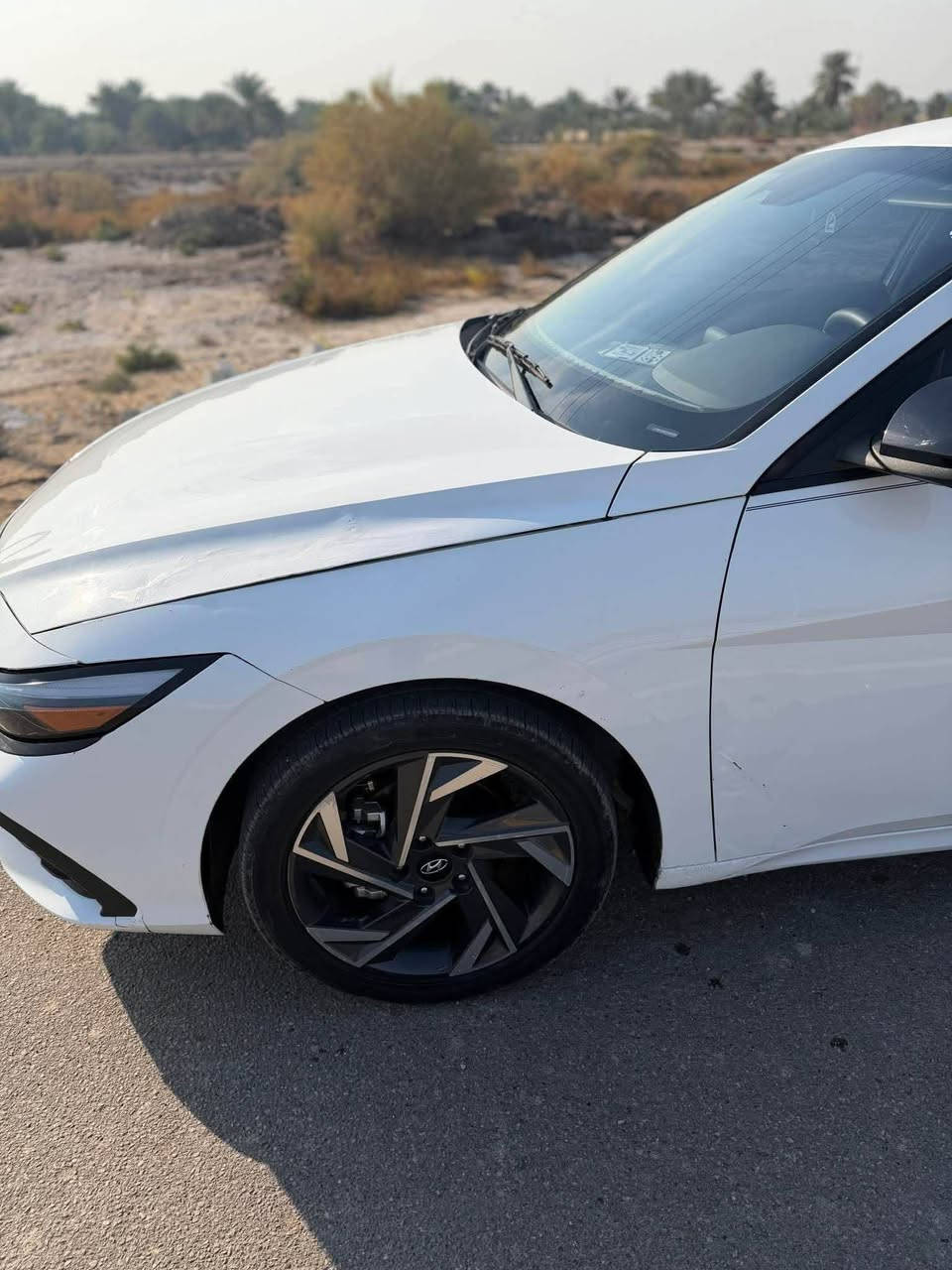 هونداي النترا(2025),امريكي
مكينه 2000 دوش 

ماشي 10 الف 

بصمه 

رادار امامي 

رادار خلفي 

رادار بلمري 

شاشه جبيره 

كيج الكتروني 

اناره ترحيب 

دشبول 7 الوان متغير / تحكم ستيرن / كامره خلفيه / ويل كب لايتات لد  لد 

حادث سياره جاملغ امامي ايسر تبديل ارباك ستيرن 

فقط لا شاصي لا الغد كفاله عامه من كلشي عده جملغ تبديل اصلي نفس الون 

 سعر 155 وبي مجال بسيط 

بدون رقم تترقم جميع المحفضات

 العنوان  بابل حله ابي غرق 

رقم الهاتف. ابو زينب 

***********
