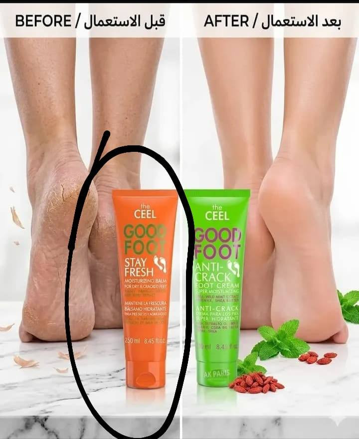 “واش باقي كتقلّب على فرصة تغيّر حياتك؟
اليوم جبت ليك الحل! مع أكابيجو، عندك فرصة تبداي مشروعك الخاص بمنتجات متنوعة وجودة عالية.
خدمة حقيقية، دعم مستمر، ونتائج كتتكلم بوحدها!
ما تضيعش الوقت… راسليني وخلي البداية تكون اليوم!https://wa.me/212638643026


**إذا كنت صاحب هذا الإعلان وتريد حذفه لأي سبب، رجاءا أرسل رسالة إلى الدعم الفني**