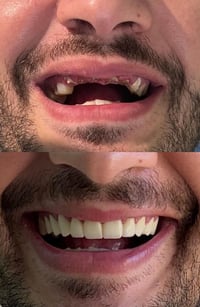 زركون • ابتسامة طبيعية • حي النصر