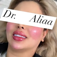 العروض الاقوى في بغداد لجميلات عيادتنة فيلر الشفاه الكوري💋 50الف فقط  ...