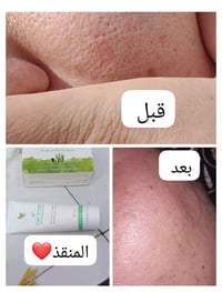 أرثري • صابونه • بديل مكياج