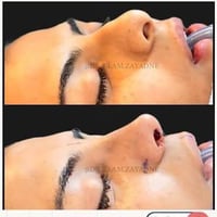 قريبا في العراق بغداد  مع الدكتور  الايراني المبدع في عمليات تجميل الا...