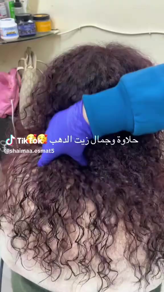 ذيت الذهب. من شركة مورا كوين 👌
GOLD OiL MORA QUEEN محمد حازم 
كلمتينننن ومن اول السطررر هنااا ممنووووع التقليدددد. علشان التقليد هيكلف خساره كبيرررره لأن كل تركايه ف المنتج معموووله ب حرفيه شديده المنتج بفضل الله خالي من اي اضرار. كمااان بيتوزع بالأيد عادي جدددا بدون مايسبب اي تهيج للبشره تعبنا ع المنتج جدددا علي نقدمه ليكم بالمستوى ددده احنا شركة كوين وأولناها من أول نزول المنتج أحنا أصحاب ذيت الذهب ولا يوجد شخص علي وجه الأرض معاه تركيبة زيت الذهب غير بفضل الله شركة مورا كوين وموزعيها ووكلائها  يعني مينفعش حد يبيعلك اي حاجه بأسم ذيت الذهب أحفظو شكل الماده كويييسسس وكماااان جودتها لأنكم بفضلللل اللله مش هتلاقو جوووده ف جمال جودة زيت الذهب   😉🤷‍♂️


**إذا كنت صاحب هذا الإعلان وتريد حذفه لأي سبب، رجاءا أرسل رسالة إلى الدعم الفني**
