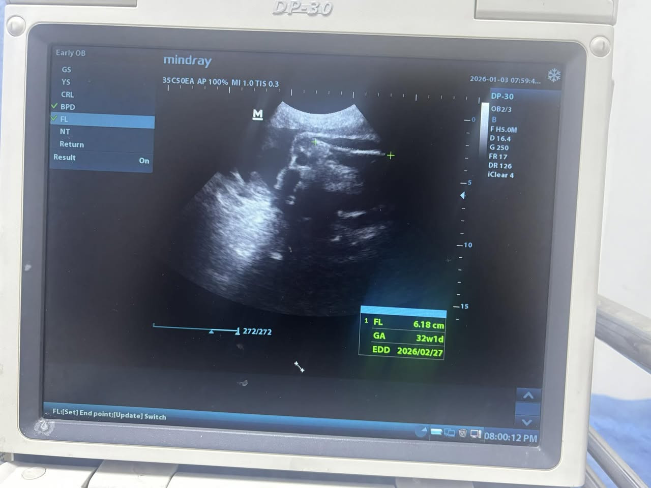 من حالات العياده
الي متابعه من الألف للياء وتطمن على سلامتها وسلامه النونو ربي يكونون بالسلامه ان شالله هي والنونو♥️🙏
ولد على ثنين بنوتات

د.انجي سعيد متي
بغداد/ابو دشير الشارع العام مجاور غذائيه ابو جواد
📍مجمع الحياه الطبي
كل ايام السبت والثنين واربعاء 
📩رقم الحجز ***********⁩
