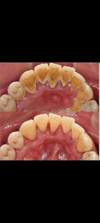 مجاناً • طب الاسنان كربلاء • علاجات اسنان