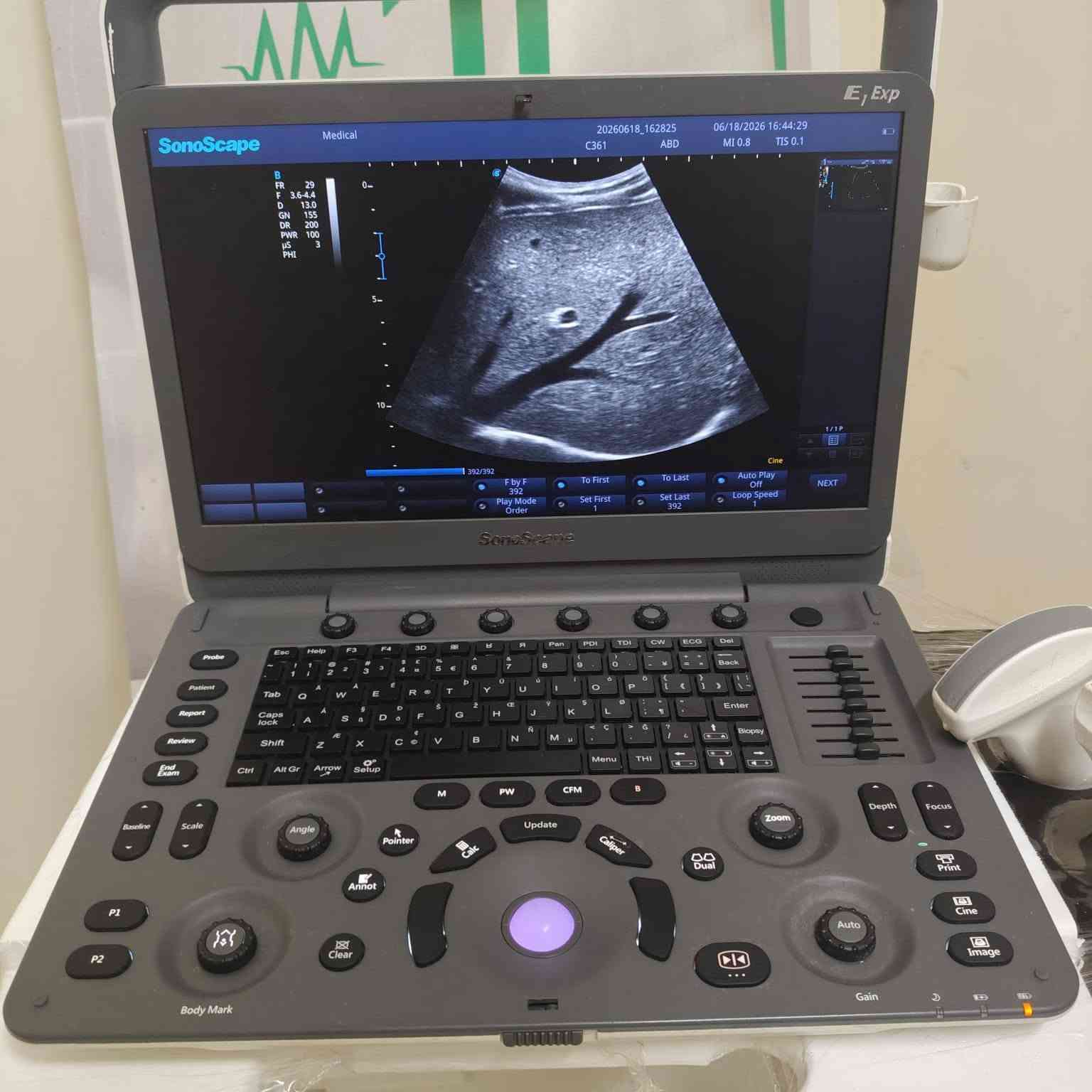 🔥 سونسكيب E1 Exp Color Doppler 🔥
✅ Color Doppler
✅ بروب كونفكس + لينير
✅ جاهز للعمل فورًا
✅ حالة ممتازة

📩 للتواصل خاص أو واتساب:
01035163941
01114878515


**إذا كنت صاحب هذا الإعلان وتريد حذفه لأي سبب، رجاءا أرسل رسالة إلى الدعم الفني**