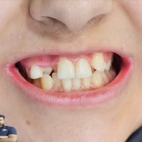 طب اسنان اطفال • سن مطمور • المسيب شارع البلدية