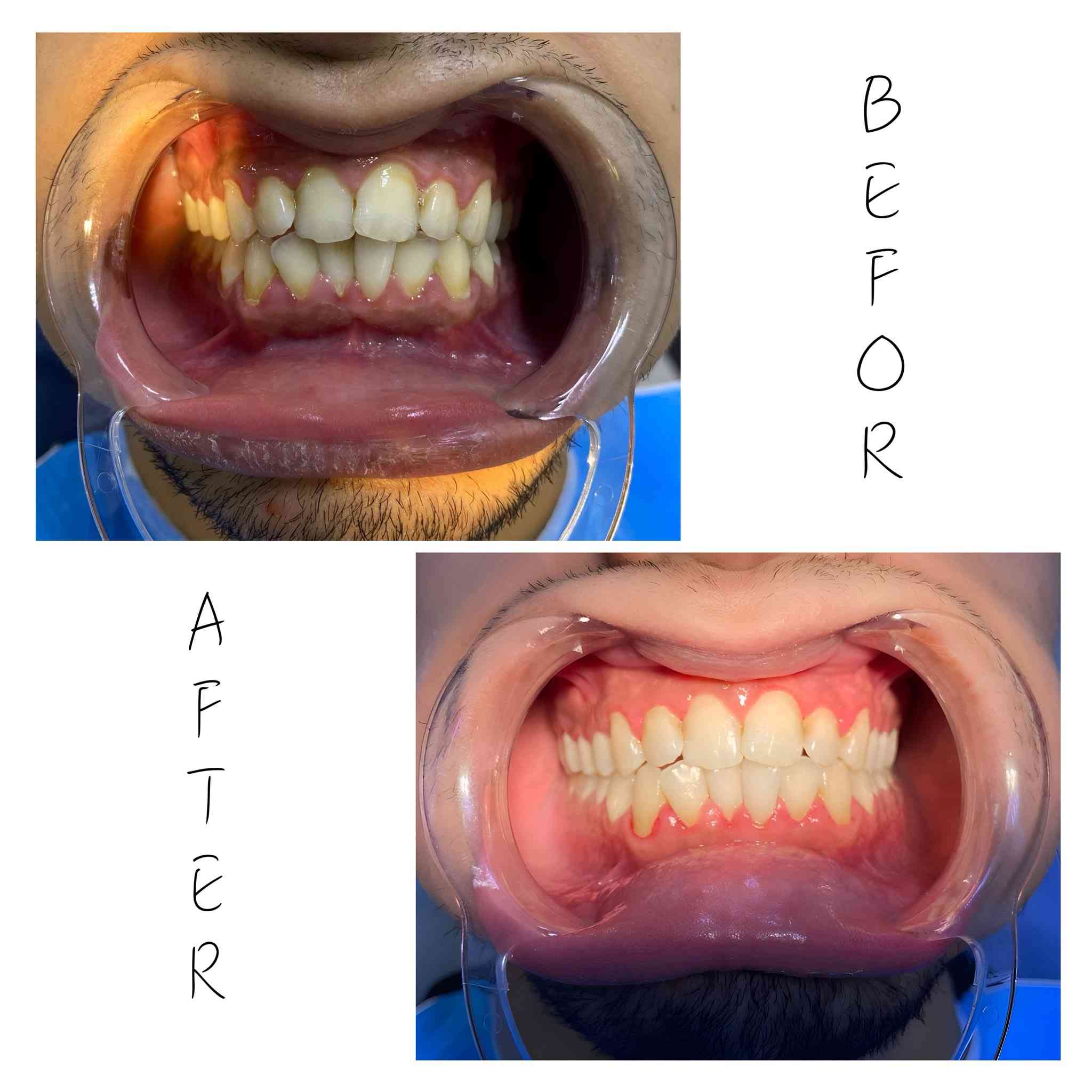 مرحبا
باجر اكو عيادة تنظيف ساعة ١١ الصبح ، للي يحب احجزلة *********** / كلية الرشيد الجامعة _ حي الحسين .
