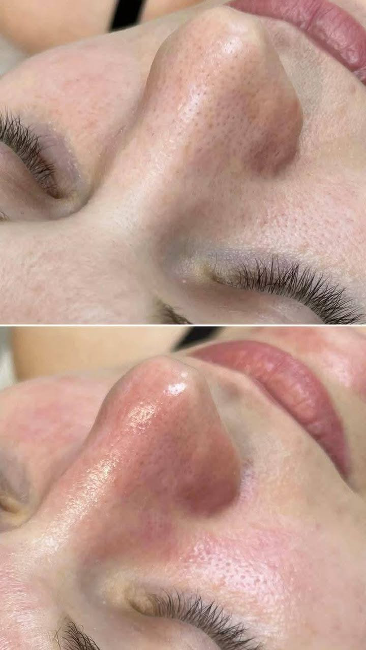 عروض عروض
تنضيف بشره عميق 10 
يشمل بخار+سناره+قناع طين+قناع اسود +سنفره للوجه+جهاز رؤوس السوده +صبغ حاجب 

تنضيف بشره عادي5
يشمل بخار +قناع +سنفره


**إذا كنت صاحب هذا الإعلان وتريد حذفه لأي سبب، رجاءا أرسل رسالة إلى الدعم الفني**
