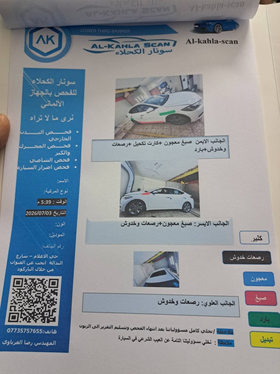 سلام عليكم النترا البيع موديل ١٧ خليجي ماشيه ١١٤ بيه قطعتين تبديل موجود سونار الاتصال ***********سعر ١٢٠ بسمي رقم بغداد
