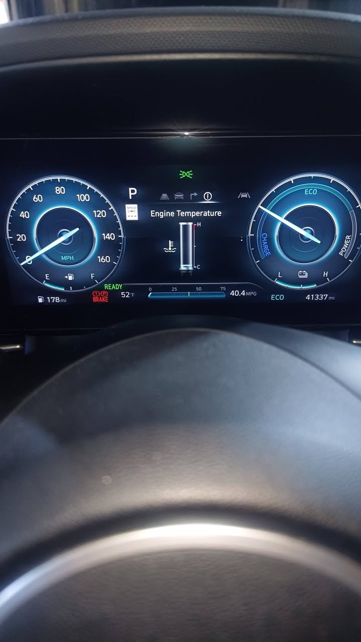 السلام عليكم اخوان النترا هايبرد 2025
السياره لمدد1/1 فول مواصفات 
السياره كلين قطرة صبغ مابيه بس بارد بالجاملغ الامام 
موضح بالصوره السياره كلش نضيفه بالعافيه الي صير 
من نصيبه الون سلفر داخل السياره ملكي السياره ماشيه 41
ميل
السعر 192 وبيه مجال 
***********
