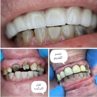 زركون ٨ اسنان • مجمع اليمامه • كادر طبي