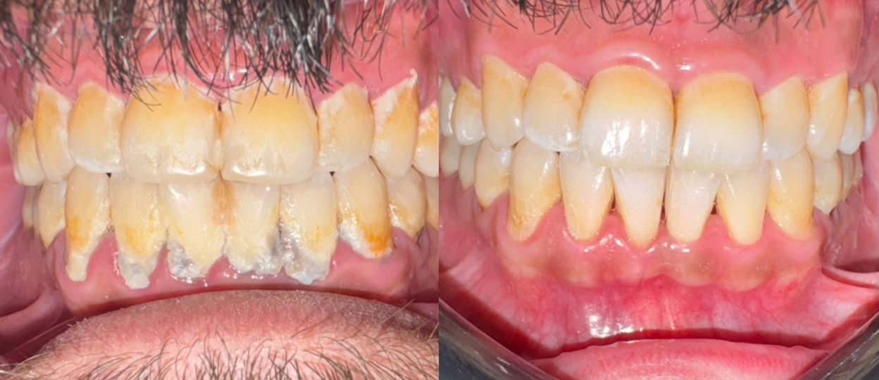مرحبا بنوتات  شلونكم
وياكم د.شهدسعدي اخصائيه تقويم و سرتفكيت تجميل اسنان متواجدة بعيادة عياده الرحيق لطب وتجميل الاسنان قرب سوق علي نعمة السبت الاثنين الاربعاء صارلنا خمس سنوات والحمدلله مراجعينا يعرفون شون شغلنا نظيف و علمي و ننصح بالشي الزين و اسعارنا مناسبه 
رح اخليلكم صور من شغلي و اي استفسار عدكم تكدرون تتواصلون ويانه على الرقم *********** 
وهذا حسابي على الانستا 
https://www.instagram.com/drshahadsaadi618?igsh=Mjhkemhnbzdld3R5&utm_source=qr
