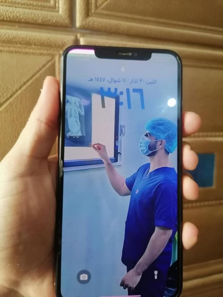 اكس ماكس ذاكرة 256 بطارية 77 مبدل شاشة أصلية وخط صغير بالشاشة السعر 140وتساب ***********
