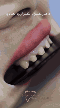 دكتور علي العبادي • الحرية ثالثة • دوام ٢-٨م